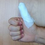 I cut my thumb